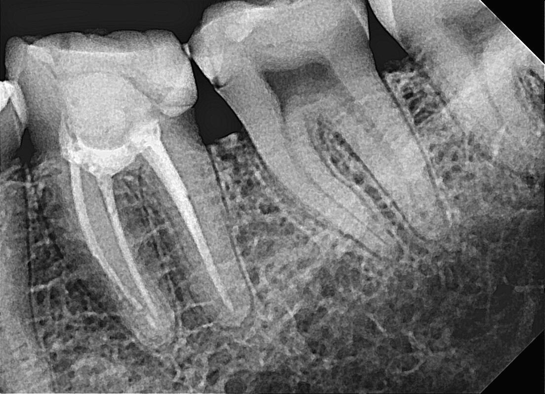 Dentalni radiogram