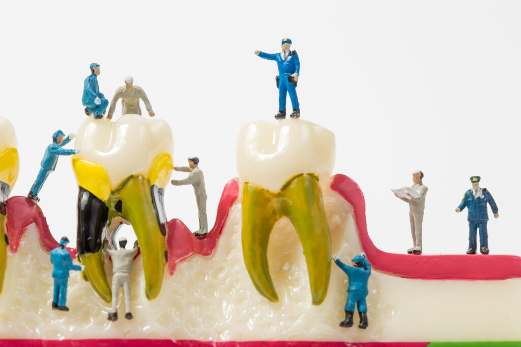 People to clean tooth model on white background,miniature