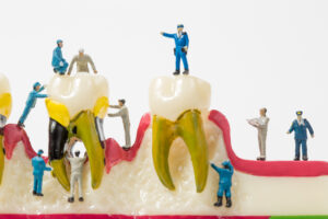 People to clean tooth model on white background,miniature