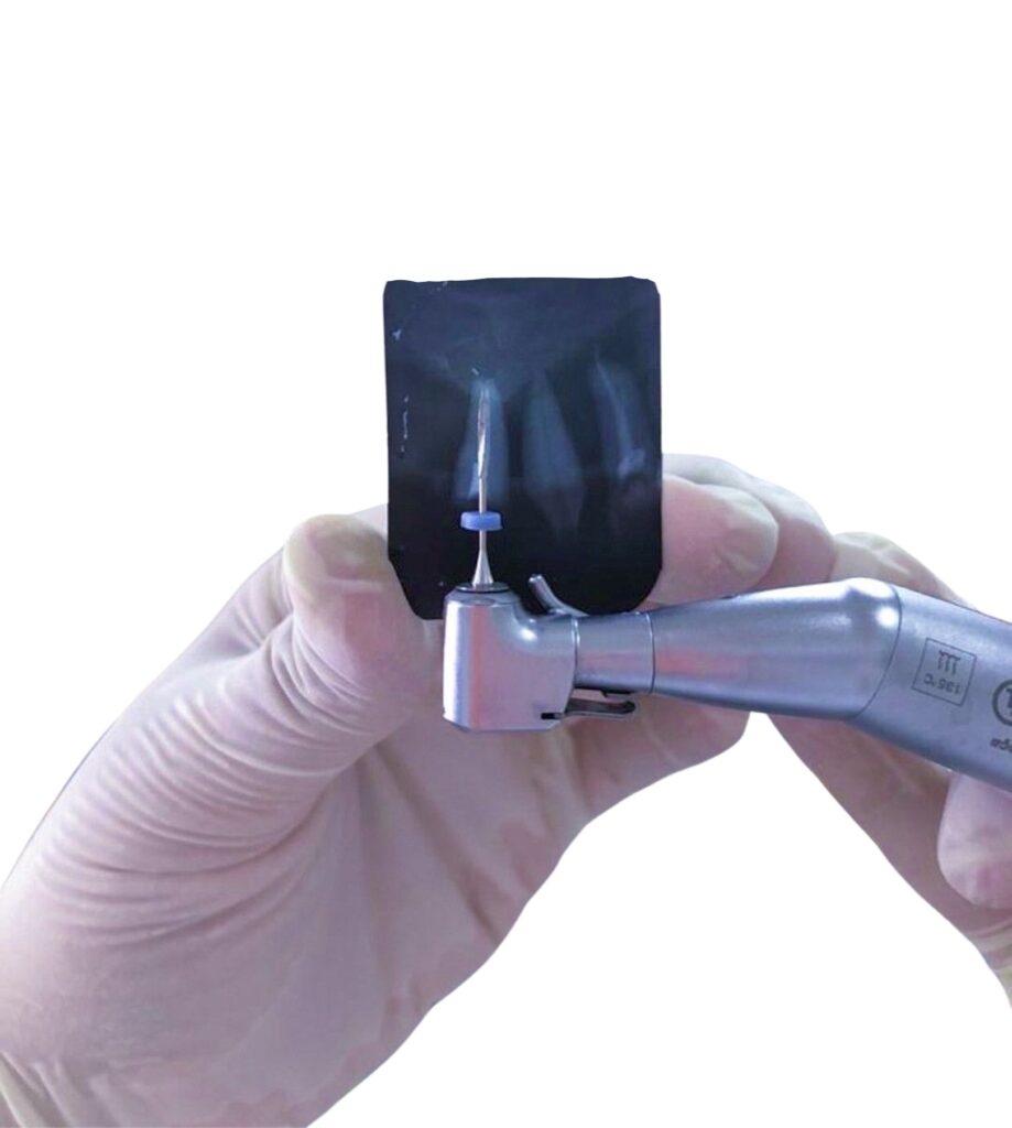 Pulsiranje zuba pulpitis